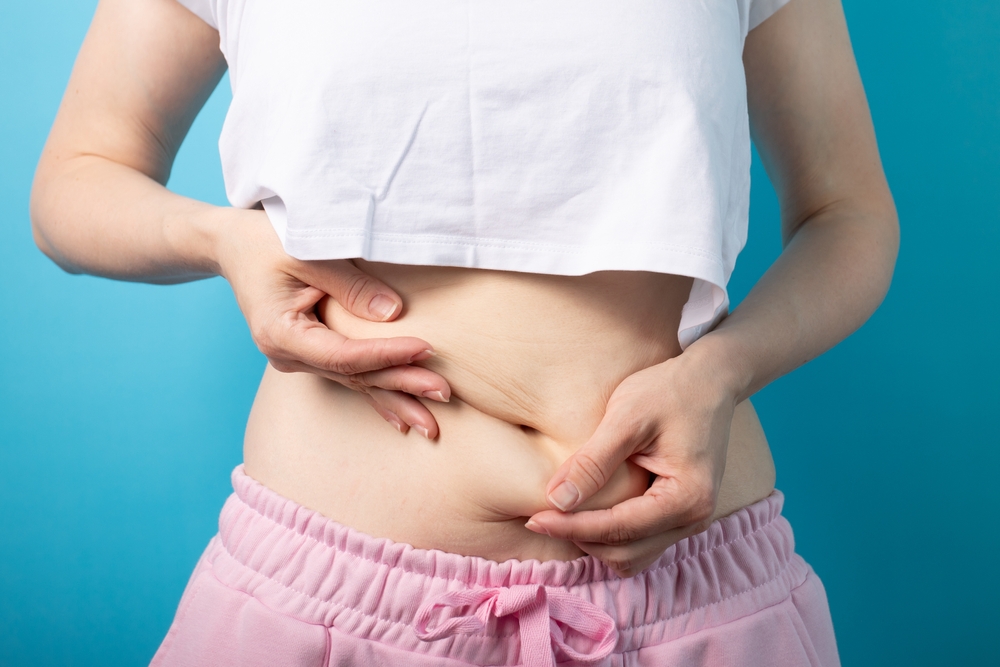 Stubborn Belly Fat After Kids? Why Diet and Exercise Aren’t Always Enough